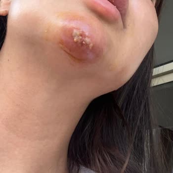 Sena Medikal Estetik Şikayetçiyim