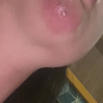 Sena Medikal Estetik Şikayetçiyim