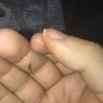 Sütaş Kaymağın İçinden Kıl Çıktı!