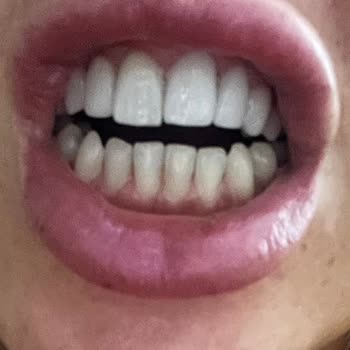 Dr. Çağdaş Kışlaoğlu Klinikteki İşlem Sonrası Ücret Sorunu