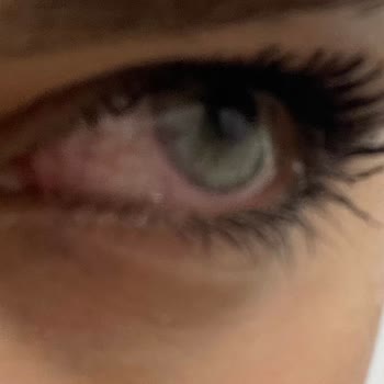 Labella Lens Lens Rahatsızlığı Ve İlgisiz Müşteri Hizmetleri