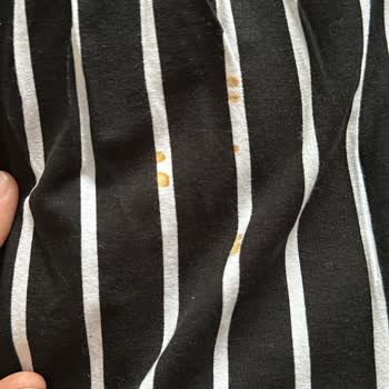 Suwen İnternet Mağazasından Gönderilen Defolu Pijama Takımı Hakkında