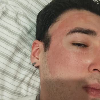 Claderm Killi Yüz Maskesi