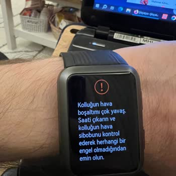 Huawei Watch D Blood Pressure Error