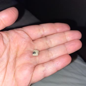 Başakşehir Ortodonti Skandalını Siz De Yaşamayın!