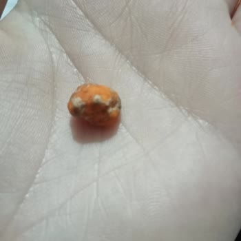 Amigo Soslu Cips Fıstık'dan Taş Çıktı