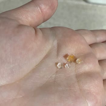 ChildGen Üründen Cam Benzeri Cisimler Çıktı