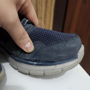 Skechers Spor Ayakkabının Kalitesizliği!