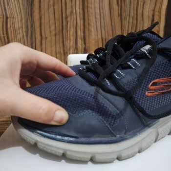 Skechers Spor Ayakkabının Kalitesizliği!