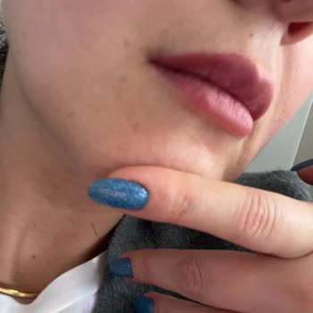 Loccitane İndirimde Bozuk Ürün
