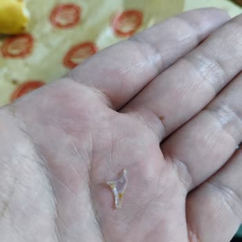 Pizza Hut Pizzada Plastik, Keskin Yabancı Madde.