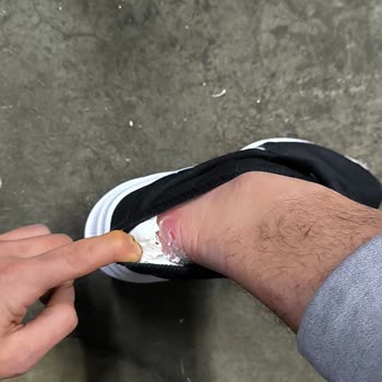 Nike Downshifter 11 Topuk Vurması