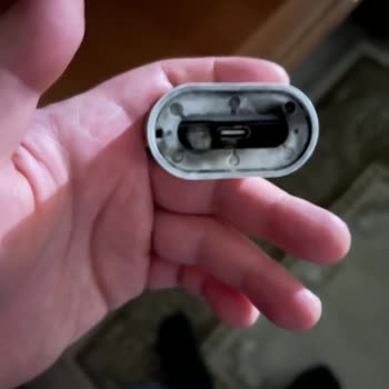 iPhone İ Phone Şarj Aleti Çocuğun Elinde Patladı Dava Edeceğim