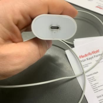 iPhone İ Phone Şarj Aleti Çocuğun Elinde Patladı Dava Edeceğim