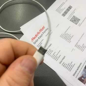 iPhone İ Phone Şarj Aleti Çocuğun Elinde Patladı Dava Edeceğim