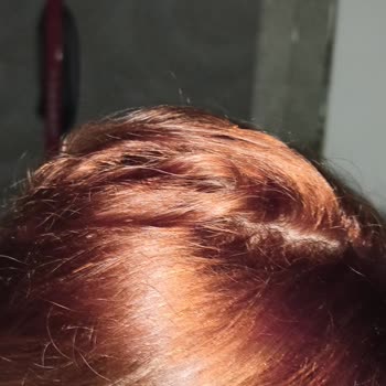 Loreal Paris İsmine Yakışmadı