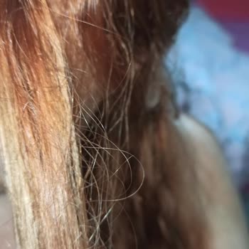 Loreal Paris İsmine Yakışmadı