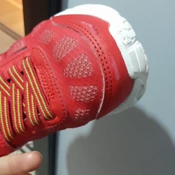 1 Haftada Deforme Olan Skechers Ayakkabı