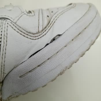4 Ayda Yıpranan Adidas Ayakkabı Ve İade Sorunu