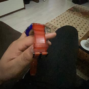 Versace Saatimde Yaşanan Kordon Kararması Sorunu