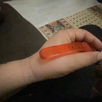 Versace Saatimde Yaşanan Kordon Kararması Sorunu