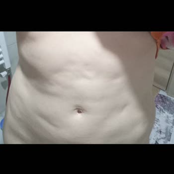 Sağlık Bakanlığı Liposuction Sonrası Beklenmedik Sonuçlar