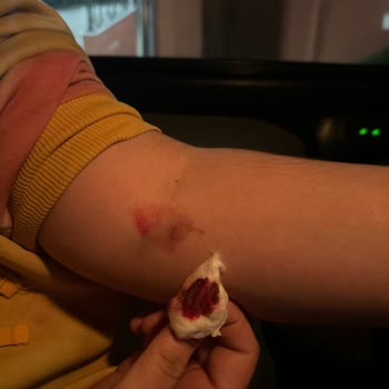 Yedikule Göğüs Hastalıkları Ve Göğüs Cerrahisi Eğitim Ve Araştırma Hastanesi Hastanede Kan Alma Ve EKG İşlemlerinde Yaşanan Sorunlar