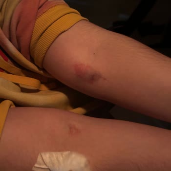 Yedikule Göğüs Hastalıkları Ve Göğüs Cerrahisi Eğitim Ve Araştırma Hastanesi Hastanede Kan Alma Ve EKG İşlemlerinde Yaşanan Sorunlar