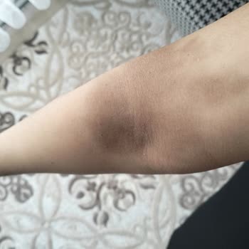 Özel Ortadoğu Hastanesi (Mersin) Tarsus Ortadoğu Hastanesi Şikayet Var