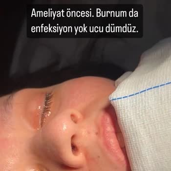 Vanity Estetik'de  Yaşanan Tıbbi Sorun Ve İletişim Skandalı