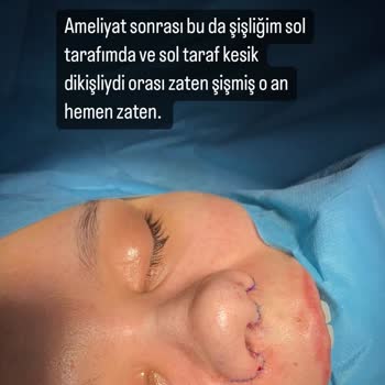 Vanity Estetik'de  Yaşanan Tıbbi Sorun Ve İletişim Skandalı