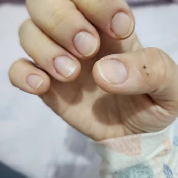 Arzu Topuz Beauty Manikür Adı Diye Parmaklarımı Parçaladı