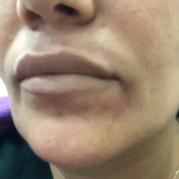 Maybelline New York İade Acilen Alerji Oldum