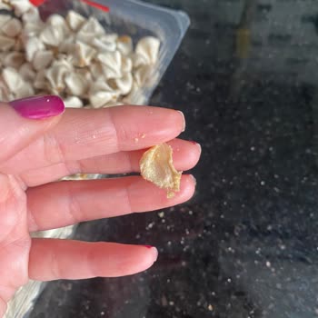 Kaşık-la Mantı Kaşıkla Mantıda Yabancı Cisim