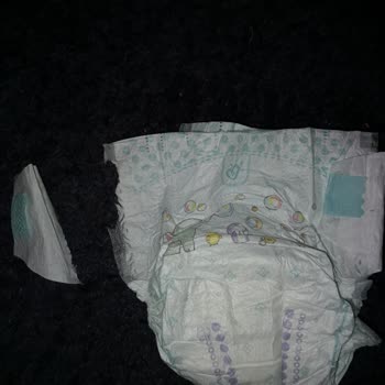 Prima Aktif Bebek Yapıştırma Bölümleri Kopuyor
