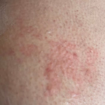 Emsan Düdüklü Pişmanlıktır