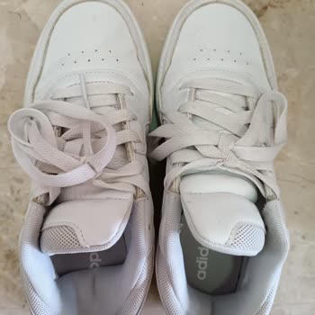 Adidas Garanti Veriyor Ama Asla Ürününe Sahip Çıkmıyor