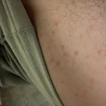 Eyüp Sabri Tuncer Bodrum Mandalinası Alerjik