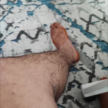 Esenyurt Necmi Kadıoğlu Devlet Hastanesi Esenyurt Devlet Hastanesinin Yanlış Teşhis Sonucu Ayağımın Kesilmesi