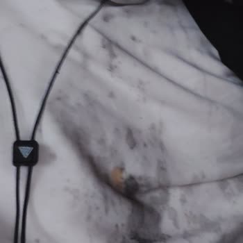 Lüks Adana Klimanın Pis Suyu Üzerime Aktı