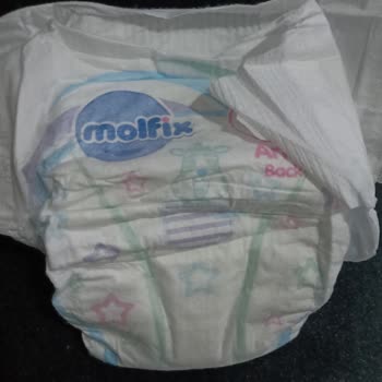 Molfix Bezde İğne Gibi Sert Cisim Çıktı