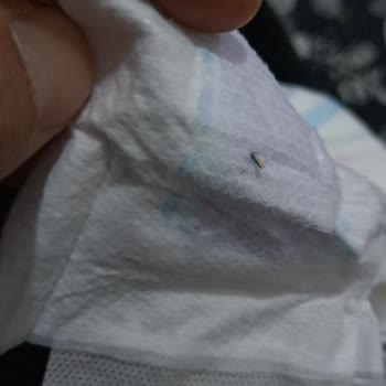 Molfix Bezde İğne Gibi Sert Cisim Çıktı