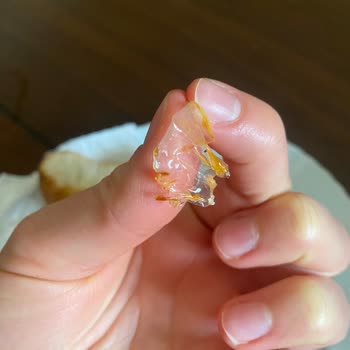 BİM Plastik Parçalı Köfte Şikayeti