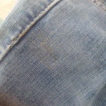 Lives Pantolondan Asla Çıkmayan Lekeler