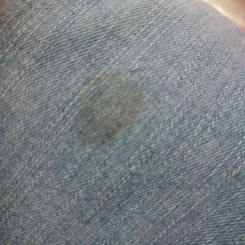 Lives Pantolondan Asla Çıkmayan Lekeler