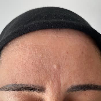 Elenora Güzellik Merkezi Kalıcı Kaş İşlemi Hayal Kırıklığı