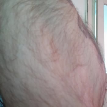 Venice Estetik & Güzellik Venice Clinic Land Estetik Mağduriyet Sonuç Alamama