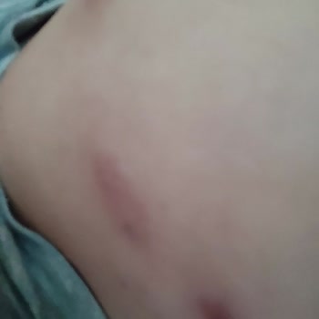 Venice Estetik & Güzellik Venice Clinic Land Estetik Mağduriyet Sonuç Alamama