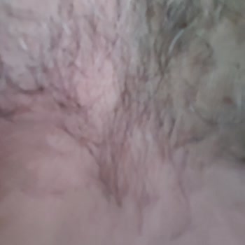 Venice Estetik & Güzellik Venice Clinic Land Estetik Mağduriyet Sonuç Alamama