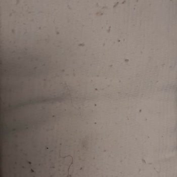 Penti Duyarsızlığı Ve Yetersizliği